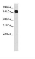 ZFP64 Antibody - Transfected 293T Cell Lysate.  This image was taken for the unconjugated form of this product. Other forms have not been tested.