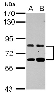 ZFP64 Antibody - Sample (30 ug of whole cell lysate) A: HeLa B: HepG2 7.5% SDS PAGE ZFP64 antibody diluted at 1:1000