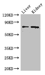 ZFP64 Antibody - Western Blot Positive WB detected in: Mouse liver tissue, Mouse kidney tissue All lanes: ZFP64 antibody at 4µg/ml Secondary Goat polyclonal to rabbit IgG at 1/50000 dilution Predicted band size: 75, 69, 73, 49, 47 kDa Observed band size: 75 kDa