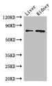 ZFP64 Antibody - Western Blot Positive WB detected in: Mouse liver tissue, Mouse kidney tissue All lanes: ZFP64 antibody at 4µg/ml Secondary Goat polyclonal to rabbit IgG at 1/50000 dilution Predicted band size: 75, 69, 73, 49, 47 kDa Observed band size: 75 kDa