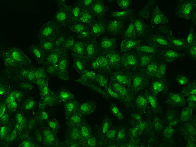 ZFP64 Antibody - Immunofluorescence staining of ZFP64 in U2OS cells. Cells were fixed with 4% PFA, permeabilzed with 0.1% Triton X-100 in PBS, blocked with 10% serum, and incubated with rabbit anti-Human ZFP64 polyclonal antibody (dilution ratio 1:200) at 4°C overnight. Then cells were stained with the Alexa Fluor 488-conjugated Goat Anti-rabbit IgG secondary antibody (green). Positive staining was localized to Nucleus.