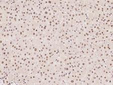 ZFP64 Antibody - Immunochemical staining of human ZFP64 in human liver with rabbit polyclonal antibody at 1:100 dilution, formalin-fixed paraffin embedded sections.