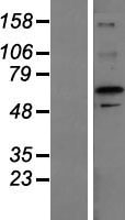ZFP64 Protein - Western validation with an anti-DDK antibody * L: Control HEK293 lysate R: Over-expression lysate