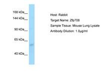 Zfp708 Antibody -  This image was taken for the unconjugated form of this product. Other forms have not been tested.