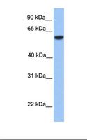 ZFP82 / ZNF545 Antibody - Fetal brain lysate. Antibody concentration: 1.0 ug/ml. Gel concentration: 12%.  This image was taken for the unconjugated form of this product. Other forms have not been tested.