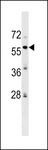 ZFP82 / ZNF545 Antibody - ZFP82 Antibody western blot of HepG2 cell line lysates (35 ug/lane). The ZFP82 antibody detected the ZFP82 protein (arrow).