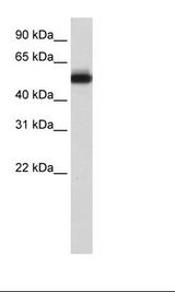 ZFP82 / ZNF545 Antibody - Transfected 293T Cell Lysate.  This image was taken for the unconjugated form of this product. Other forms have not been tested.