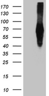 ZFP82 / ZNF545 Antibody - HEK293T cells were transfected with the pCMV6-ENTRY control. (Left lane) or pCMV6-ENTRY ZFP82. (Right lane) cDNA for 48 hrs and lysed