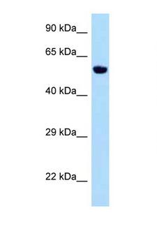 Zfp874b Antibody - Zfp874b antibody Western blot of Mouse Kidney lysate. Antibody concentration 1 ug/ml.  This image was taken for the unconjugated form of this product. Other forms have not been tested.