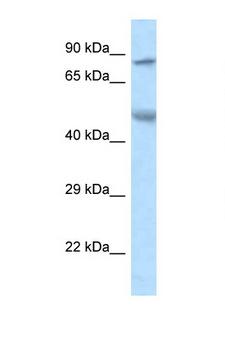 ZFP90 Antibody - ZFP90 antibody Western blot of Mouse Pancreas lysate. Antibody concentration 1 ug/ml.  This image was taken for the unconjugated form of this product. Other forms have not been tested.