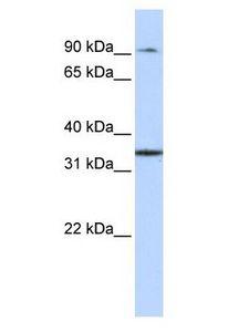 ZFP90 Antibody - ZFP90 antibody Western Blot of Human Liver.  This image was taken for the unconjugated form of this product. Other forms have not been tested.