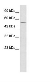 ZFP91 Antibody - HepG2 Cell Lysate.  This image was taken for the unconjugated form of this product. Other forms have not been tested.