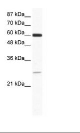 ZFP91 Antibody - Jurkat Cell Lysate.  This image was taken for the unconjugated form of this product. Other forms have not been tested.