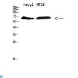 ZFP91 Antibody - Western Blot (WB) analysis of HepG2, NT28 cells using Antibody diluted at 1:500.
