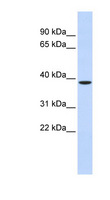 ZFPL1 Antibody - ZFPL1 antibody Western blot of Fetal liver lysate. This image was taken for the unconjugated form of this product. Other forms have not been tested.