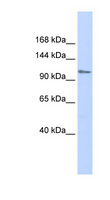 ZFPM1 / FOG1 Antibody - ZFPM1 / FOG1 antibody Western blot of Fetal Muscle lysate. This image was taken for the unconjugated form of this product. Other forms have not been tested.