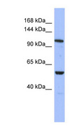 ZFPM1 / FOG1 Antibody - ZFPM1 / FOG1 antibody Western blot of THP-1 cell lysate. This image was taken for the unconjugated form of this product. Other forms have not been tested.