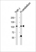 ZFPM1 / FOG1 Antibody - All lanes : Anti-ZFPM1 Antibody at 1:2000 dilution Lane 1: THP-1 whole cell lysates Lane 2: human cerebellum lysates Lysates/proteins at 20 ug per lane. Secondary Goat Anti-Rabbit IgG, (H+L), Peroxidase conjugated at 1/10000 dilution Predicted band size : 105 kDa Blocking/Dilution buffer: 5% NFDM/TBST.