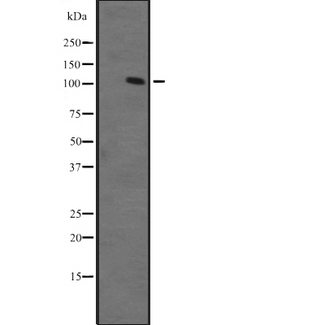 ZFPM1 / FOG1 Antibody - Western blot analysis of ZFPM1 expression in Ant fetal muscle lysate. The lane on the left is treated with the antigen-specific peptide.