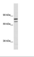 ZFPM1 / FOG1 Antibody - SP2/0 Cell Lysate.  This image was taken for the unconjugated form of this product. Other forms have not been tested.