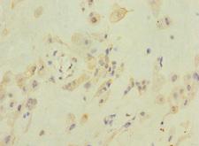 ZFPM2 / FOG2 Antibody - Immunohistochemistry of paraffin-embedded human placenta tissue at dilution 1:100