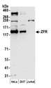 ZFR Antibody - Detection of human ZFR by western blot. Samples: Whole cell lysate (50 µg) from HeLa, HEK293T, and Jurkat cells prepared using NETN lysis buffer. Antibody: Affinity purified rabbit anti-ZFR antibody used for WB at 0.4 µg/ml. Detection: Chemiluminescence with an exposure time of 30 seconds.