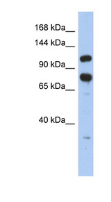 ZFR Antibody - ZFR antibody Western blot of HT1080 cell lysate. This image was taken for the unconjugated form of this product. Other forms have not been tested.