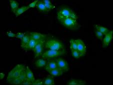 ZFR Antibody - Immunofluorescence staining of HepG2 cells diluted at 1:100, counter-stained with DAPI. The cells were fixed in 4% formaldehyde, permeabilized using 0.2% Triton X-100 and blocked in 10% normal Goat Serum. The cells were then incubated with the antibody overnight at 4°C.The Secondary antibody was Alexa Fluor 488-congugated AffiniPure Goat Anti-Rabbit IgG (H+L).