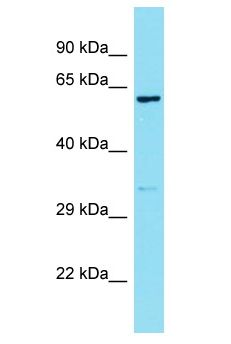 ZFX Antibody - ZFX antibody Western Blot of Stomach Tumor. Antibody dilution: 1 ug/ml.  This image was taken for the unconjugated form of this product. Other forms have not been tested.