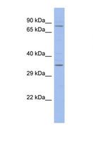 ZFX Antibody - Western blot of Human ACHN. ZFX antibody dilution 1.0 ug/ml.  This image was taken for the unconjugated form of this product. Other forms have not been tested.