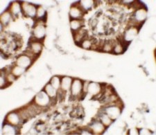 ZFX Antibody - Immunohistochemistry of ZFX in human small intestine tissue with ZFX antibody at 5 ug/ml.