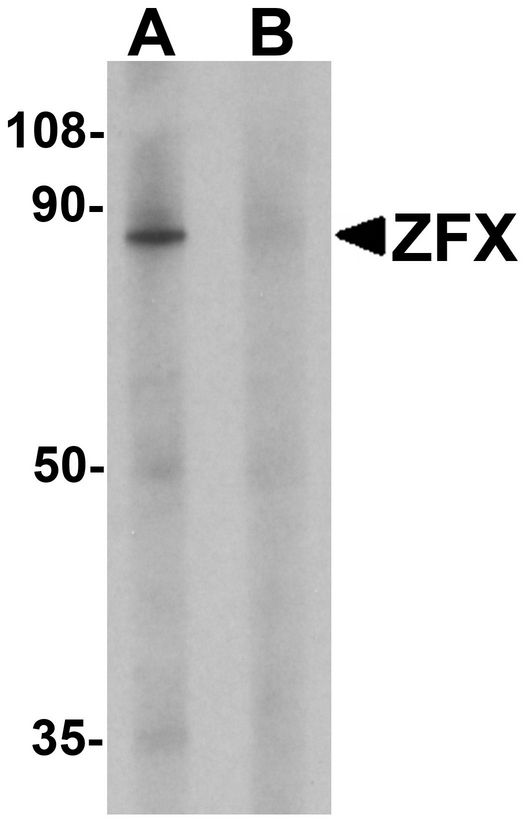 ZFX Antibody - Western blot analysis of ZFX human small intestine tissue lysate with ZFX antibody at 1 ug/ml in (A) the absence and (B) the presence of blocking peptide.