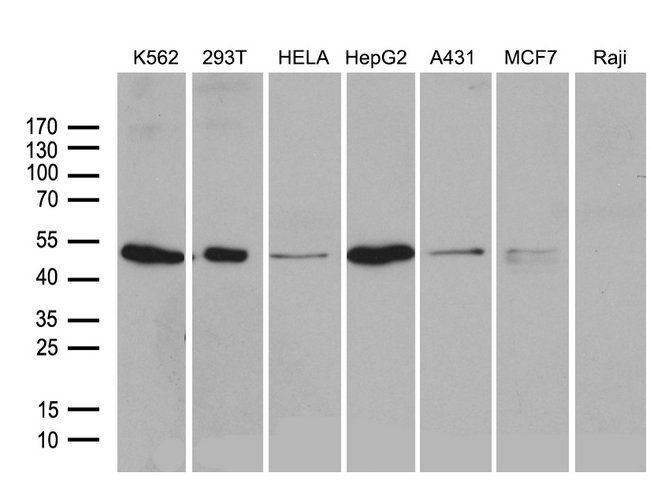 ZFYVE1 / DFCP1 Antibody - Western blot analysis of extracts. (35ug) from 7 different cell lines by using anti-ZFYVE1 monoclonal antibody. (1:500)