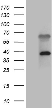 ZFYVE1 / DFCP1 Antibody - HEK293T cells were transfected with the pCMV6-ENTRY control. (Left lane) or pCMV6-ENTRY ZFYVE1. (Right lane) cDNA for 48 hrs and lysed