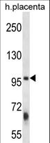 ZFYVE1 / DFCP1 Antibody - ZFYVE1 Antibody western blot of human placenta tissue lysates (35 ug/lane). The ZFYVE1 antibody detected the ZFYVE1 protein (arrow).