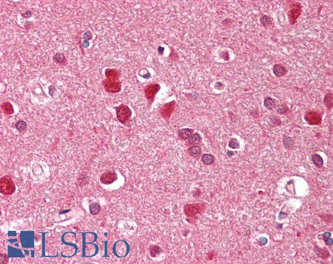 ZFYVE1 / DFCP1 Antibody - Anti-ZFYVE1 antibody IHC of human brain, cortex. Immunohistochemistry of formalin-fixed, paraffin-embedded tissue after heat-induced antigen retrieval. Antibody dilution 2.5-5 ug/ml. This image was taken for the unconjugated form of this product. Other forms have not been tested.