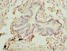 ZFYVE1 / DFCP1 Antibody - Immunohistochemistry of paraffin-embedded human lung tissue at dilution 1:100