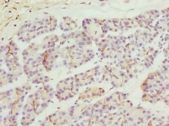 ZFYVE1 / DFCP1 Antibody - Immunohistochemistry of paraffin-embedded human pancreatic tissue at dilution 1:100