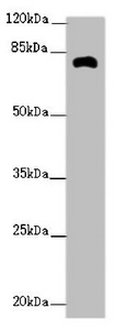 ZFYVE1 / DFCP1 Antibody - Western blot All Lanes:ZFYVE1 antibody at 2.62ug/ml +Mouse kidney tissue Goat polyclonal to rabbit at 1/10000 dilution Predicted band size: 88,41,86 kDa Observed band size: 81 kDa