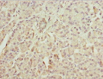 ZFYVE1 / DFCP1 Antibody - Immunohistochemistry of paraffin-embedded human pancreatic tissue at dilution 1:100