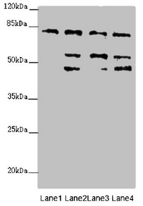 ZFYVE1 / DFCP1 Antibody - Western blot All Lanes:ZFYVE1 antibody at 6.89ug/ml Lane 1 : Hela whole cell lysate Lane 2 : 293T whole cell lysate Lane 3 : Mouse liver tissue Lane 4 : Mouse kidney tissue Secondary Goat polyclonal to Rabbit IgG at 1/10000 dilution Predicted band size: 88,41,86 kDa Observed band size: 81,54,47 kDa