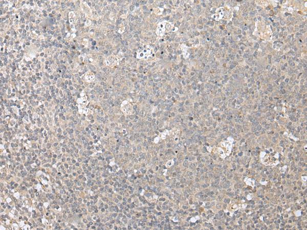 ZFYVE1 / DFCP1 Antibody - Immunohistochemistry of paraffin-embedded Human tonsil tissue  using ZFYVE1 Polyclonal Antibody at dilution of 1:40(×200)