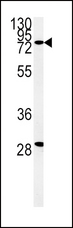 ZFYVE16 Antibody - Western blot of ZFYVE16 Antibody in K562 cell line lysates (35 ug/lane). ZFYVE16 (arrow) was detected using the purified antibody.