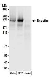 ZFYVE16 Antibody - Detection of human Endofin by western blot. Samples: Whole cell lysate (50 µg) from HeLa, HEK293T, and Jurkat cells prepared using NETN lysis buffer. Antibodies: Affinity purified rabbit anti-Endofin antibody used for WB at 0.1 µg/ml. Detection: Chemiluminescence with an exposure time of 3 seconds.