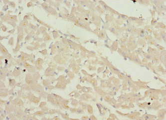 ZFYVE16 Antibody - Immunohistochemistry of paraffin-embedded human heart tissue at dilution 1:100