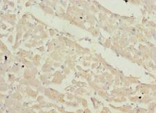 ZFYVE16 Antibody - Immunohistochemistry of paraffin-embedded human heart tissue at dilution 1:100