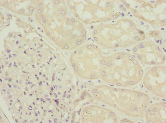 ZFYVE16 Antibody - Immunohistochemistry of paraffin-embedded human kidney tissue at dilution 1:100