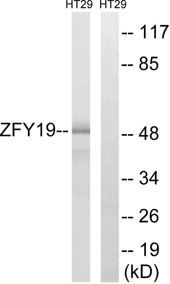 ZFYVE19 Antibody - Western blot analysis of lysates from HT-29 cells, using ZFYVE19 Antibody. The lane on the right is blocked with the synthesized peptide.