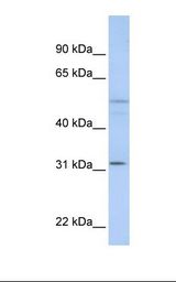 ZFYVE19 Antibody - MCF7 cell lysate. Antibody concentration: 1.0 ug/ml. Gel concentration: 12%.  This image was taken for the unconjugated form of this product. Other forms have not been tested.