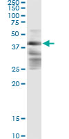 ZFYVE19 Antibody - Immunoprecipitation of ZFYVE19 transfected lysate using anti-ZFYVE19 monoclonal antibody and Protein A Magnetic Bead.